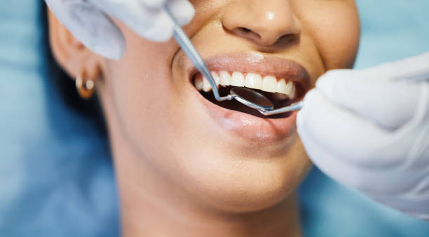 Best Emergency Dentist for Lost Fillings or Crowns in Hutto, TX