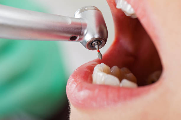 Best Pediatric Emergency Dentist in Hutto, TX
